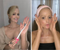 Combo Botox e Lifting Natural 360 + Renascer 25+