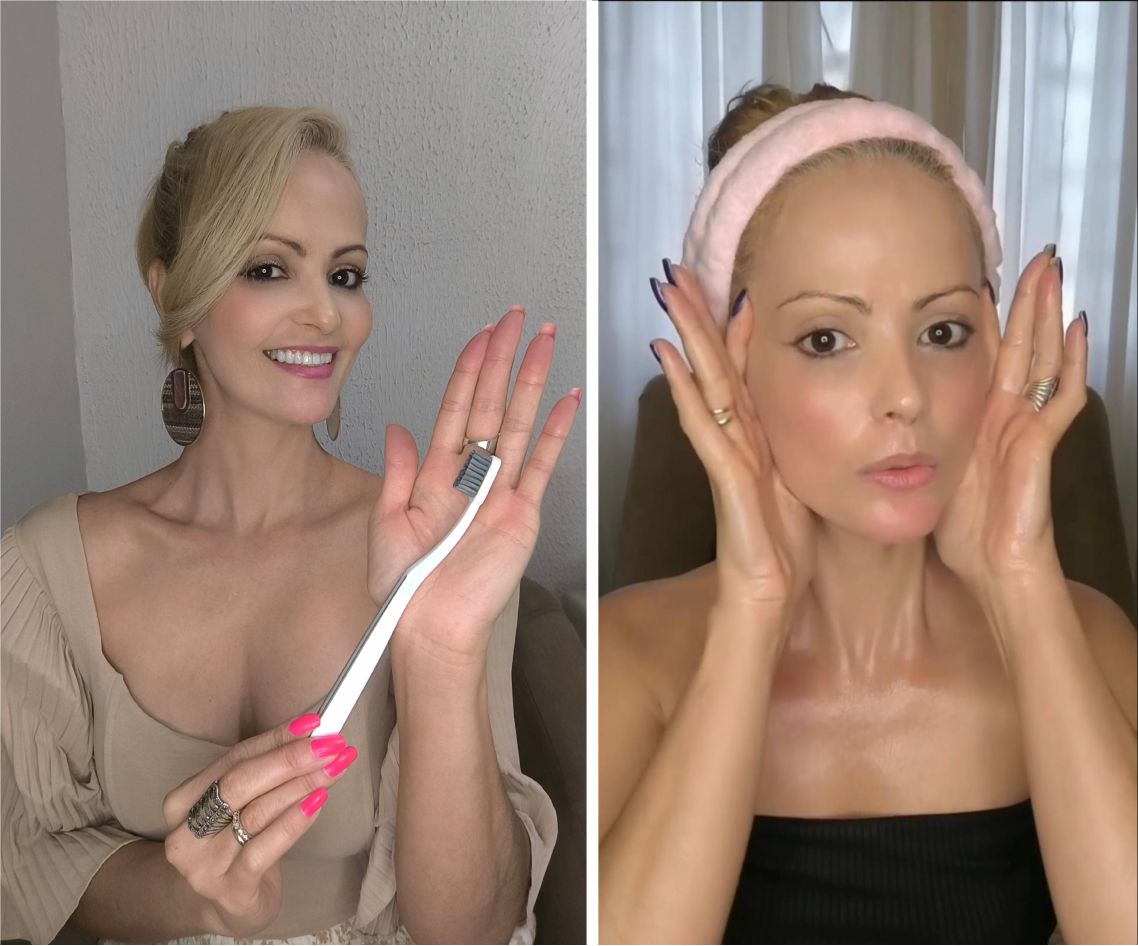 Combo Botox e Lifting Natural 360 + Renascer 25+